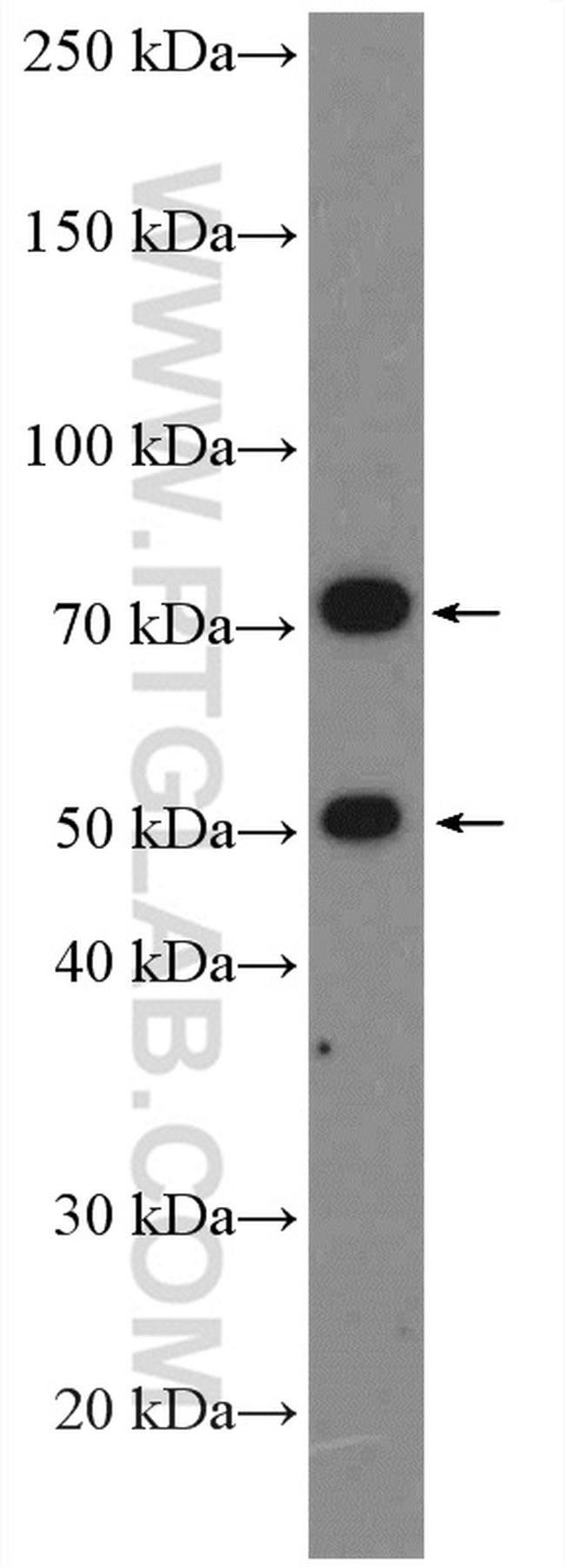 Factor XII Antibody in Western Blot (WB)