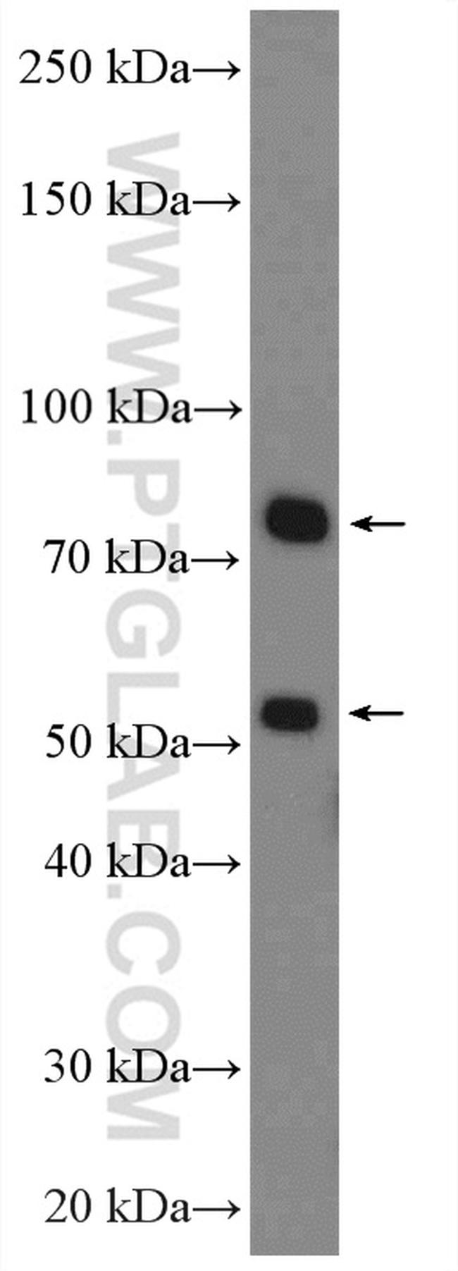 Factor XII Antibody in Western Blot (WB)