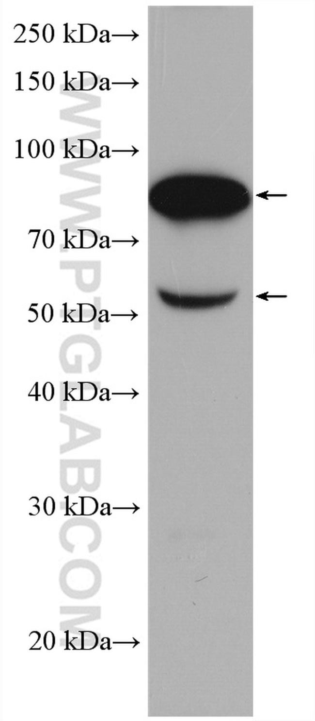 Factor XII Antibody in Western Blot (WB)