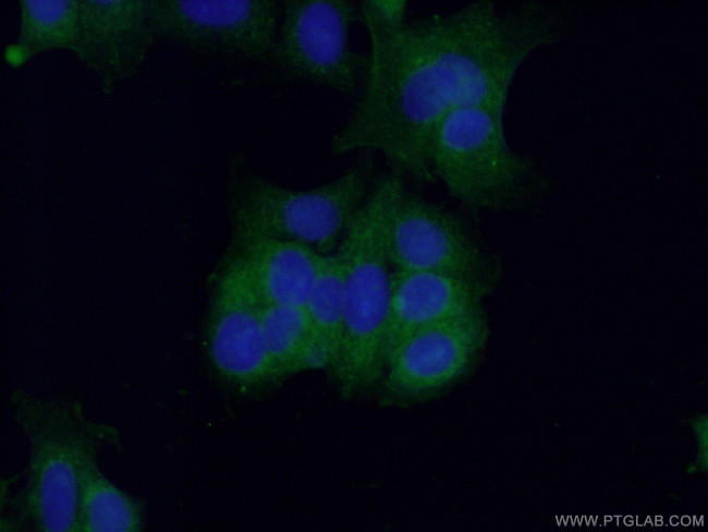 Caspase 7 Antibody in Immunocytochemistry (ICC/IF)