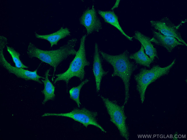 ATM Antibody in Immunocytochemistry (ICC/IF)