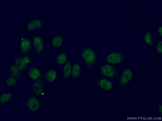 ATM Antibody in Immunocytochemistry (ICC/IF)