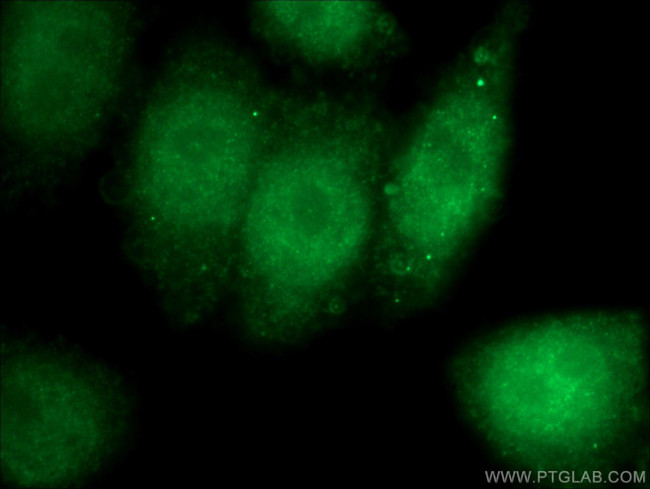 ATM Antibody in Immunocytochemistry (ICC/IF)