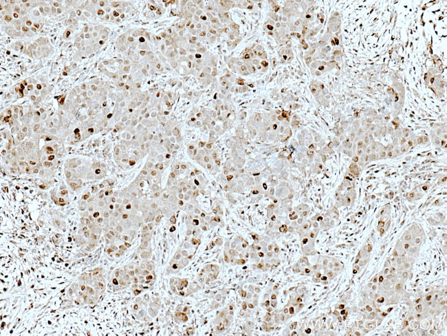 ATM Antibody in Immunohistochemistry (Paraffin) (IHC (P))