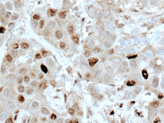 ATM Antibody in Immunohistochemistry (Paraffin) (IHC (P))