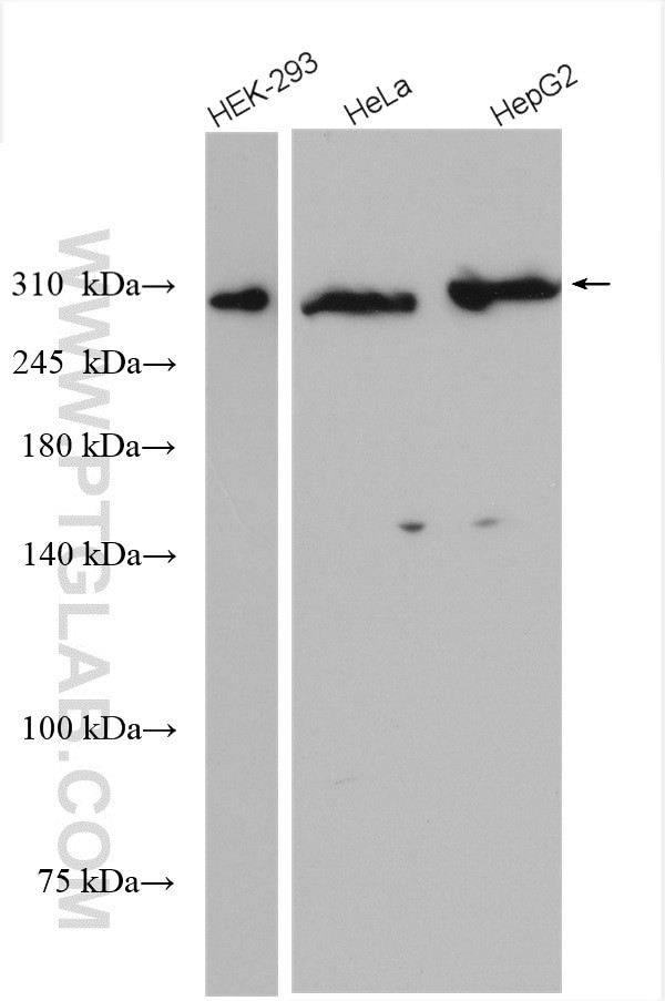 ATM Antibody in Western Blot (WB)