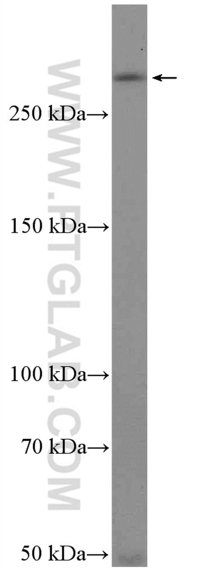 ATM Antibody in Western Blot (WB)