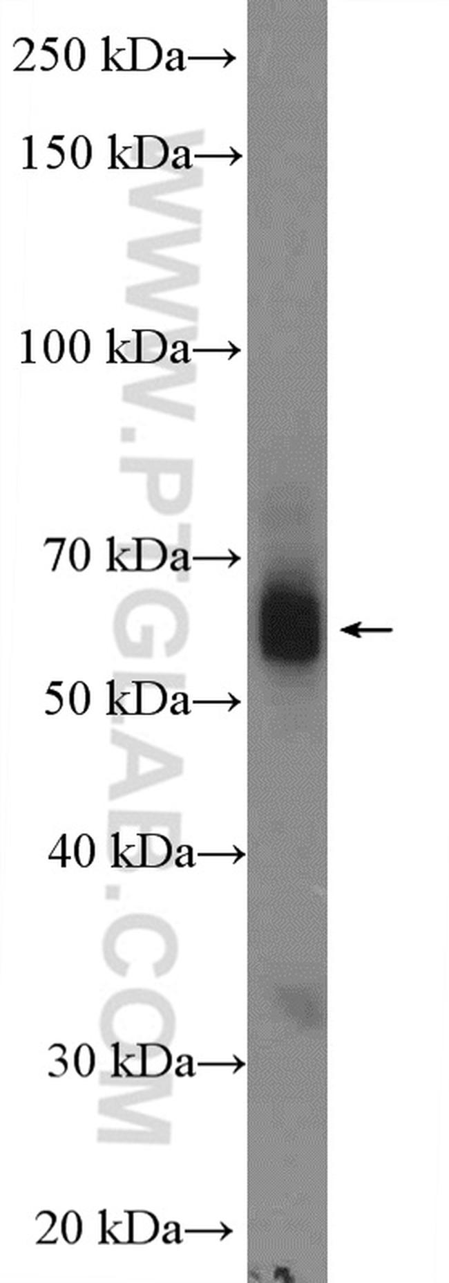 TBXA2R Antibody in Western Blot (WB)