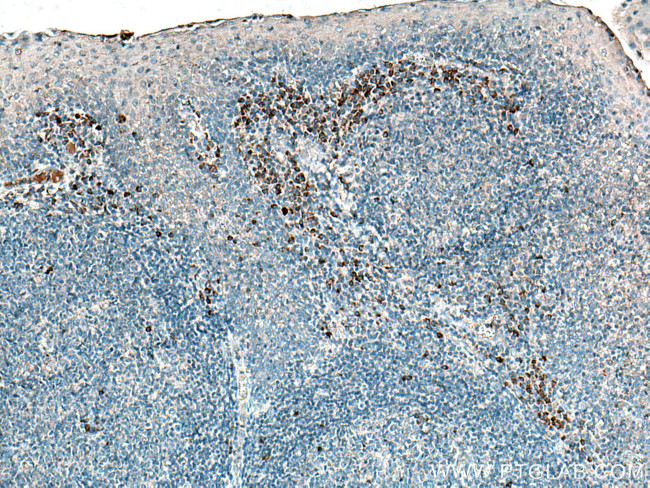 IL-23R Antibody in Immunohistochemistry (Paraffin) (IHC (P))