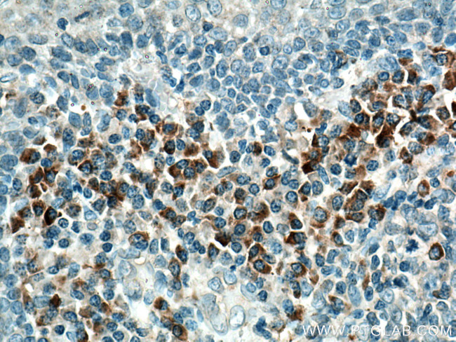 IL-23R Antibody in Immunohistochemistry (Paraffin) (IHC (P))