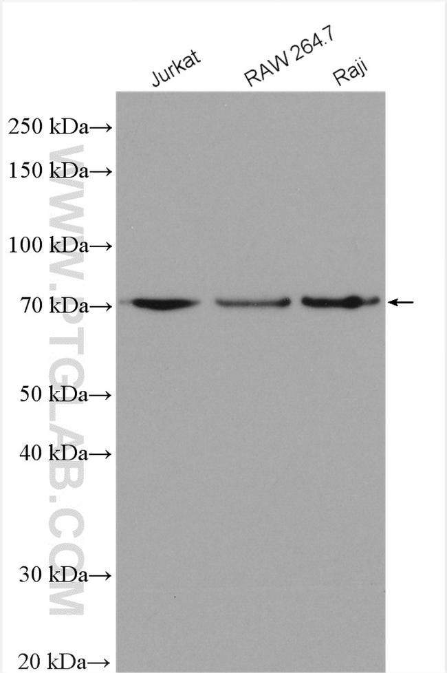 IL-23R Antibody in Western Blot (WB)