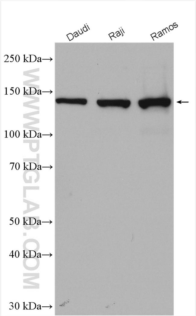 PLCG2 Antibody in Western Blot (WB)