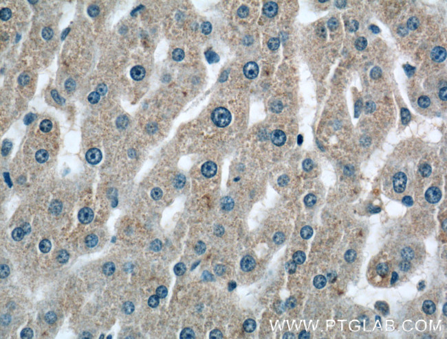 C2 Antibody in Immunohistochemistry (Paraffin) (IHC (P))