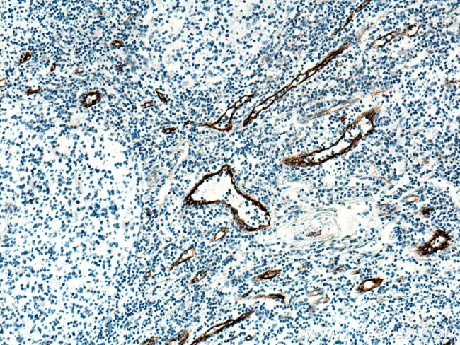 vwf Antibody in Immunohistochemistry (Paraffin) (IHC (P))