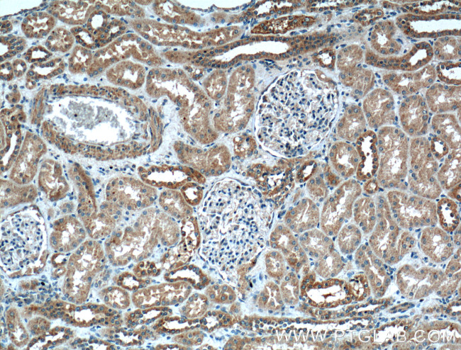 Integrin alpha-6 Antibody in Immunohistochemistry (Paraffin) (IHC (P))