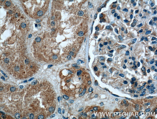 Integrin alpha-6 Antibody in Immunohistochemistry (Paraffin) (IHC (P))