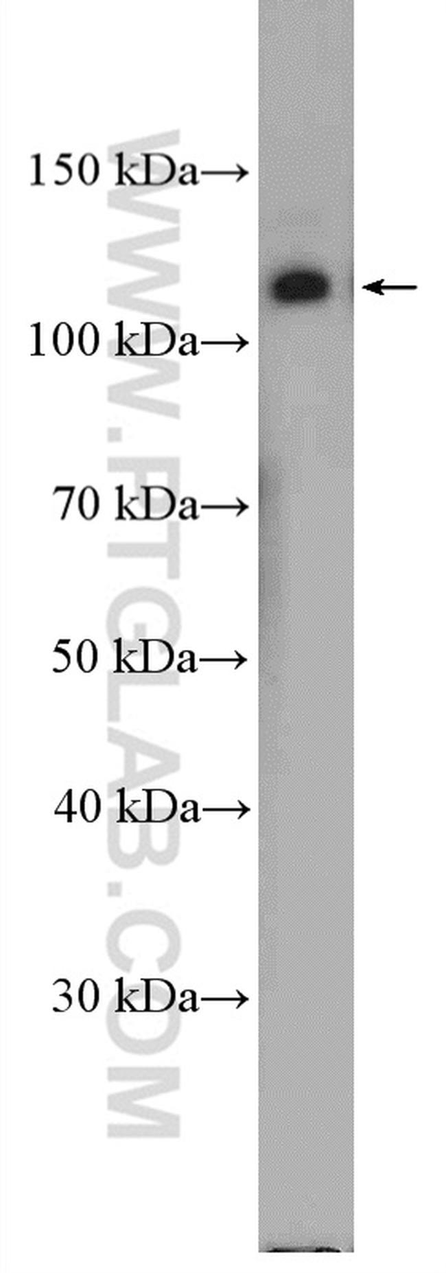 Integrin alpha-6 Antibody in Western Blot (WB)