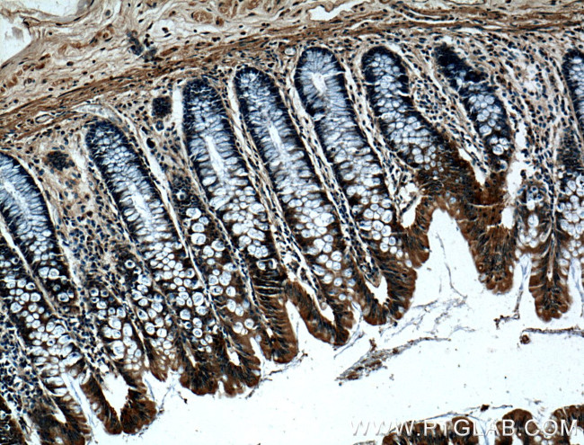 Integrin alpha-6 Antibody in Immunohistochemistry (Paraffin) (IHC (P))