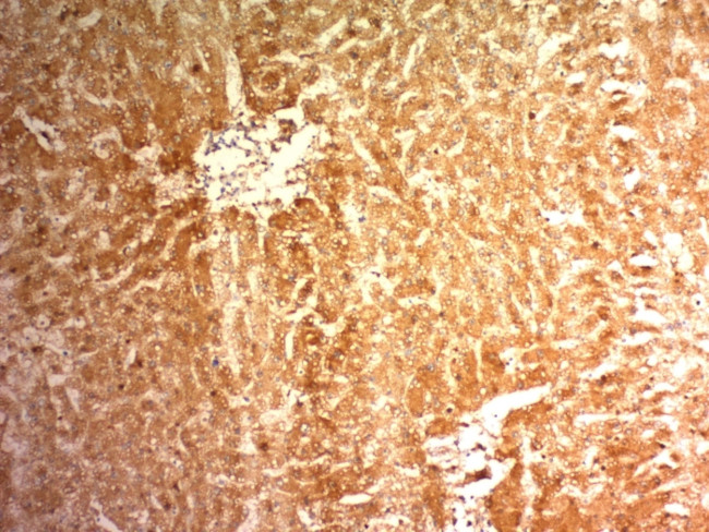 Glypican-3 (GPC3) (Hepatocellular Carcinoma Marker) Antibody in Immunohistochemistry (Paraffin) (IHC (P))