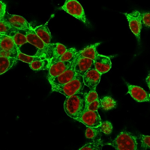 Glypican-3 (GPC3) (Hepatocellular Carcinoma Marker) Antibody in Immunocytochemistry (ICC/IF)
