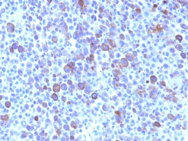 Glypican-3 (GPC3) (Hepatocellular Carcinoma Marker) Antibody in Immunohistochemistry (Paraffin) (IHC (P))