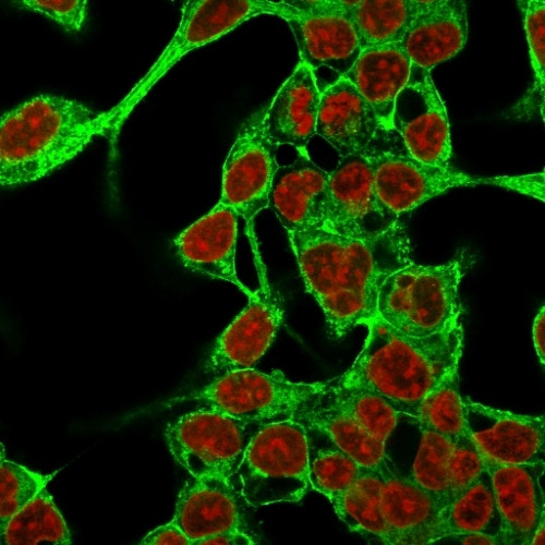 Glypican-3 (GPC3) (Hepatocellular Carcinoma Marker) Antibody in Immunocytochemistry (ICC/IF)