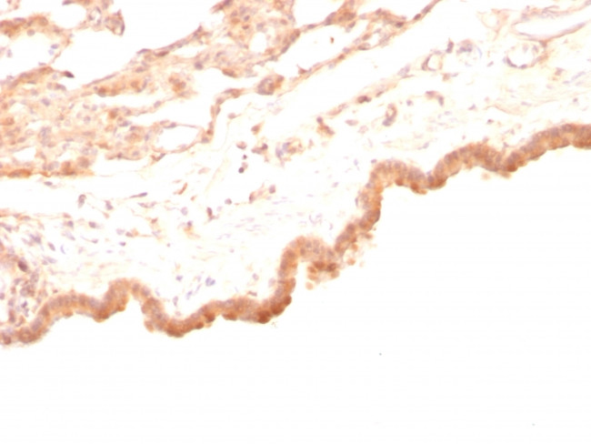 Glypican-3 (GPC3) (Hepatocellular Carcinoma Marker) Antibody in Immunohistochemistry (Paraffin) (IHC (P))