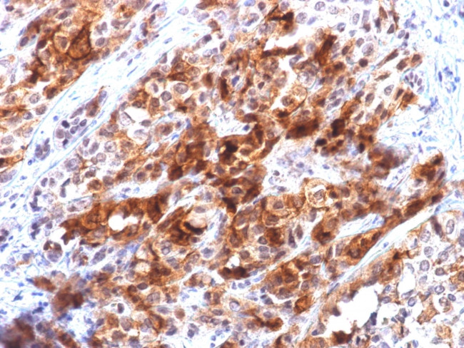 Glypican-3 (GPC3) Antibody in Immunohistochemistry (Paraffin) (IHC (P))