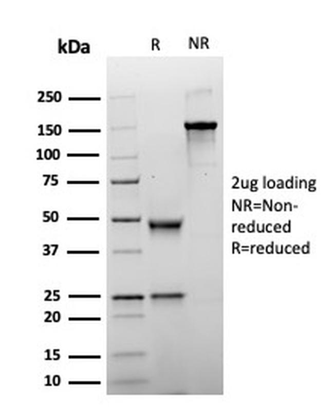 Glypican-3 (GPC3) Antibody in SDS-PAGE (SDS-PAGE)