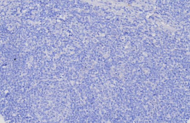 Glypican-3 (GPC3) (Hepatocellular Carcinoma Marker) Antibody in Immunohistochemistry (Paraffin) (IHC (P))