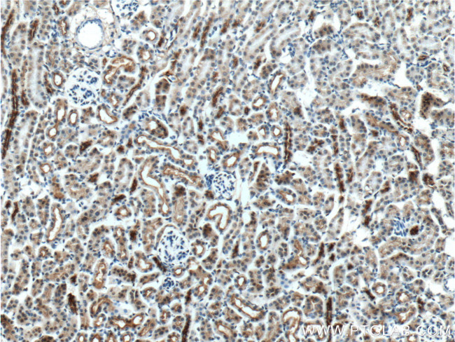 NHE3 Antibody in Immunohistochemistry (Paraffin) (IHC (P))