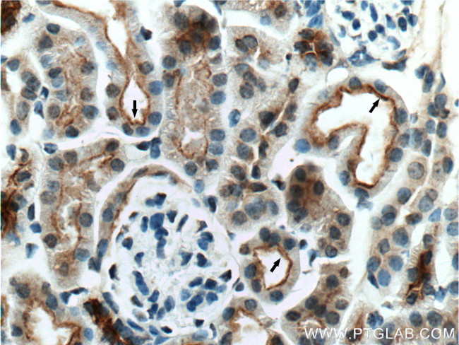 NHE3 Antibody in Immunohistochemistry (Paraffin) (IHC (P))