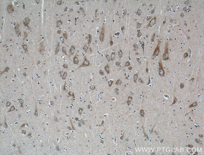 Huntingtin Antibody in Immunohistochemistry (Paraffin) (IHC (P))