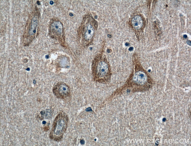 Huntingtin Antibody in Immunohistochemistry (Paraffin) (IHC (P))