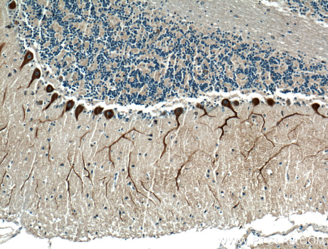 Huntingtin Antibody in Immunohistochemistry (Paraffin) (IHC (P))