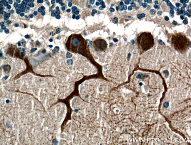 Huntingtin Antibody in Immunohistochemistry (Paraffin) (IHC (P))