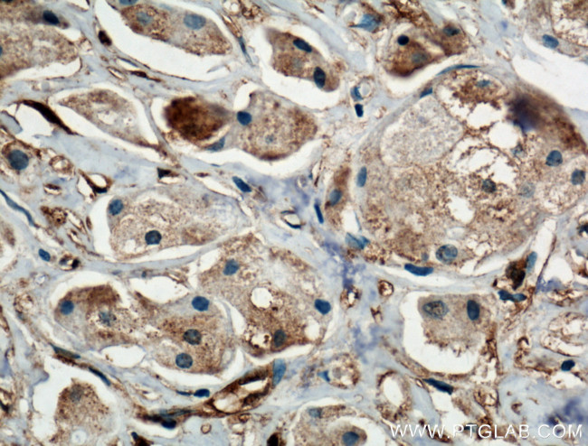 BDH2 Antibody in Immunohistochemistry (Paraffin) (IHC (P))