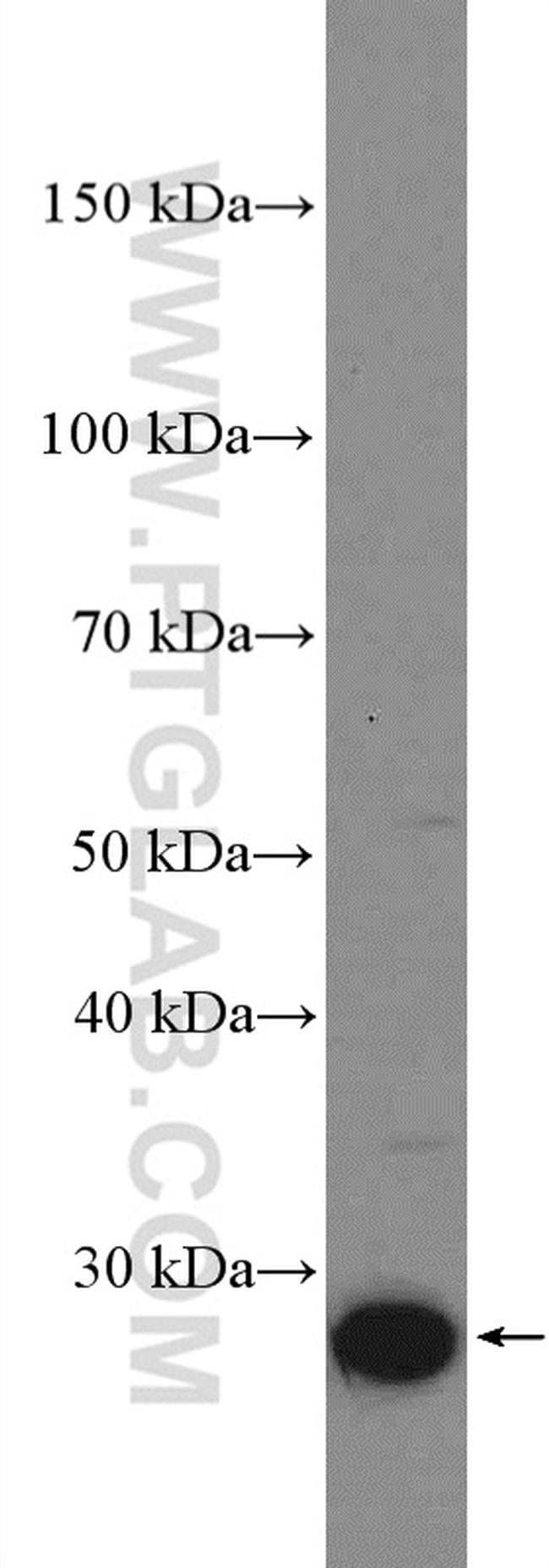 BDH2 Antibody in Western Blot (WB)