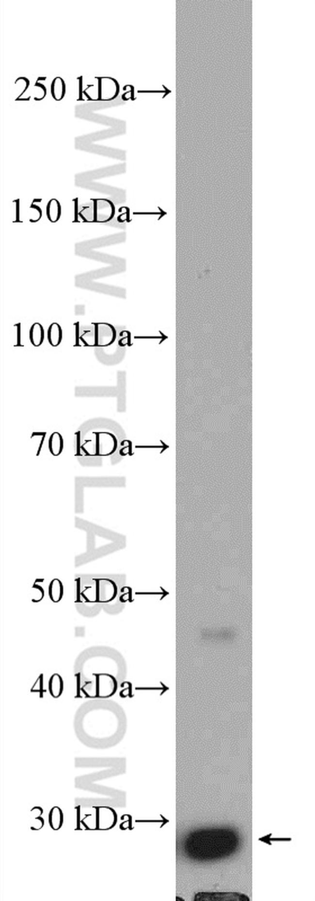 BDH2 Antibody in Western Blot (WB)