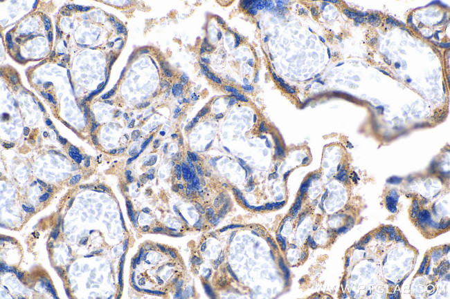 TGFBR2 Antibody in Immunohistochemistry (Paraffin) (IHC (P))