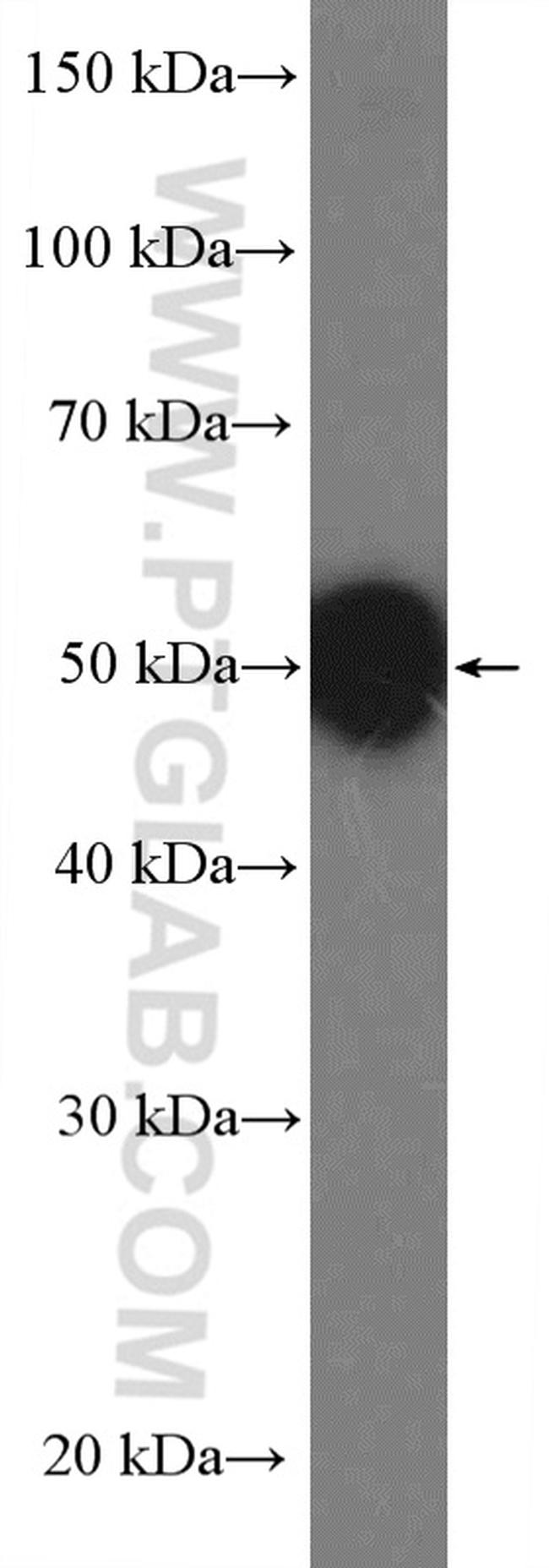 BAF53B Antibody in Western Blot (WB)