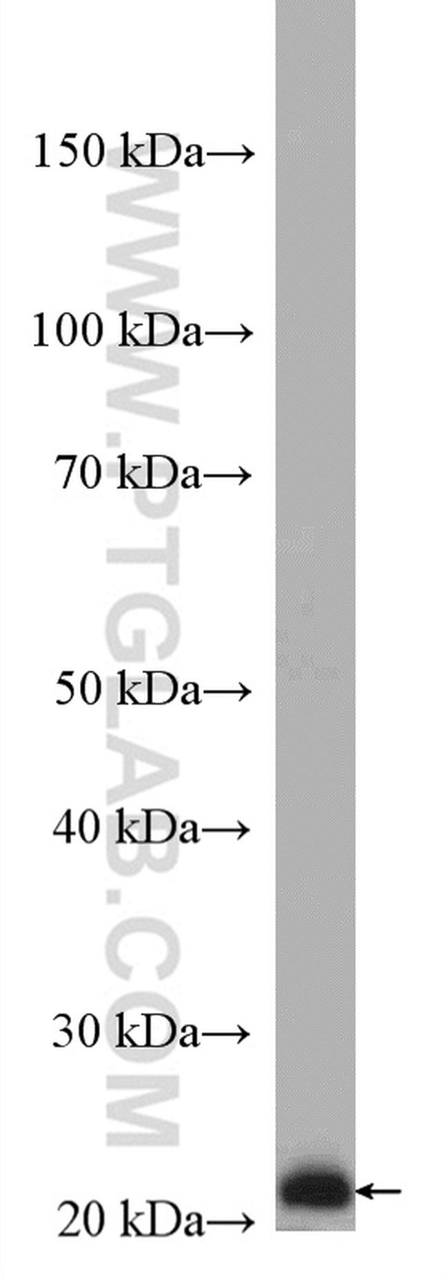 RAB5C Antibody in Western Blot (WB)