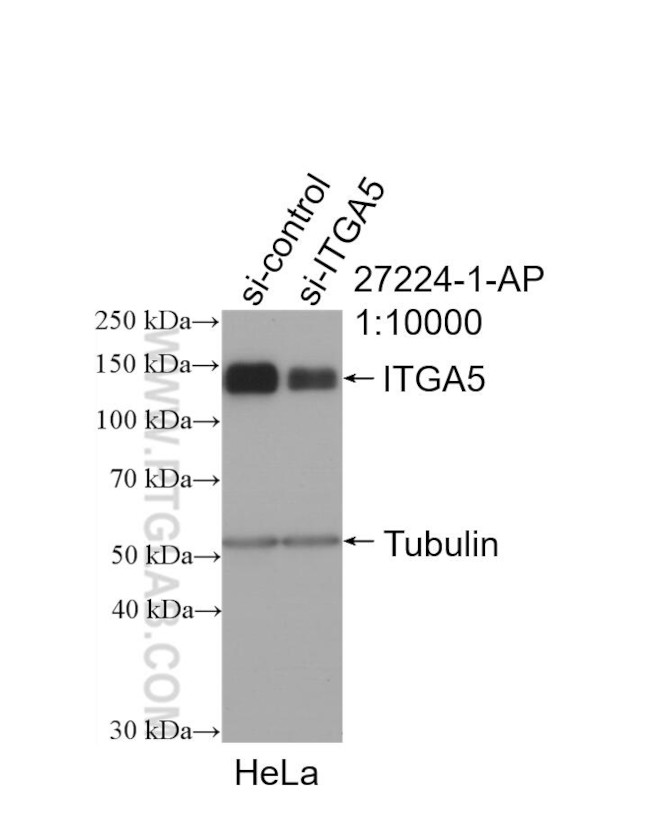 ITGA5 Antibody in Western Blot (WB)