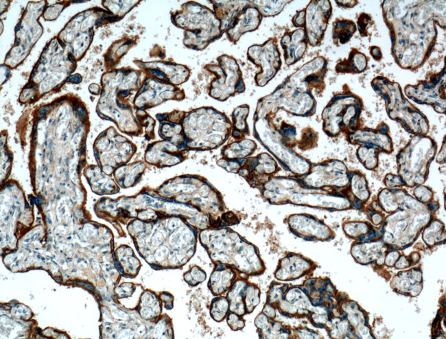 ITGA5 Antibody in Immunohistochemistry (Paraffin) (IHC (P))