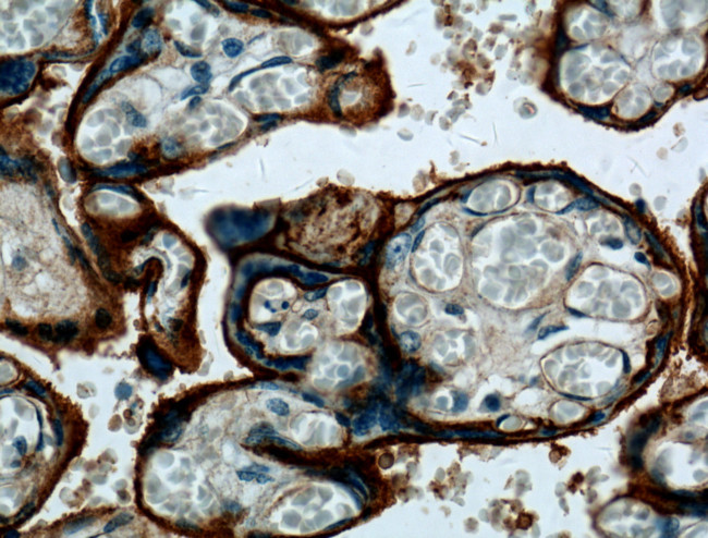 ITGA5 Antibody in Immunohistochemistry (Paraffin) (IHC (P))