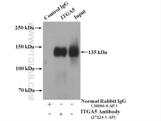 ITGA5 Antibody in Immunoprecipitation (IP)