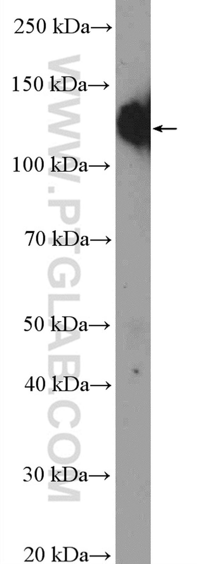 ITGA5 Antibody in Western Blot (WB)