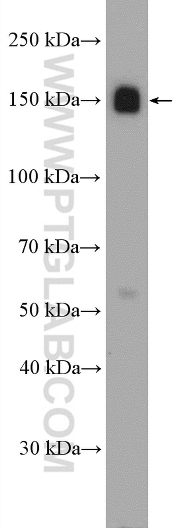 ITGA5 Antibody in Western Blot (WB)