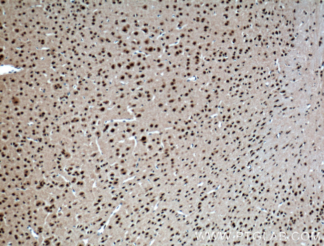 FTO Antibody in Immunohistochemistry (Paraffin) (IHC (P))