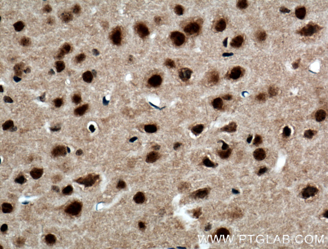 FTO Antibody in Immunohistochemistry (Paraffin) (IHC (P))